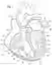 Fig. 02 - Method for converting an annuloplasty ring in vivo