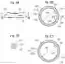 Fig. 04 - Method for converting an annuloplasty ring in vivo