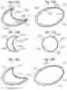 Fig. 13 - Method for converting an annuloplasty ring in vivo