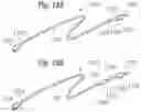 Fig. 14 - Method for converting an annuloplasty ring in vivo