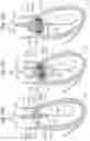 Fig. 15 - Method for converting an annuloplasty ring in vivo