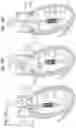 Fig. 16 - Method for converting an annuloplasty ring in vivo