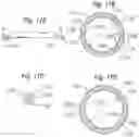 Fig. 17 - Method for converting an annuloplasty ring in vivo