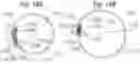 Fig. 18 - Method for converting an annuloplasty ring in vivo