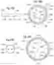 Fig. 19 - Method for converting an annuloplasty ring in vivo