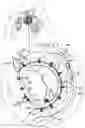 Fig. 01 - Annuloplasty implants