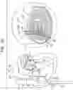 Fig. 06 - Annuloplasty implants