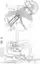 Fig. 09 - Annuloplasty implants