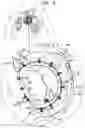 Fig. 11 - Annuloplasty implants