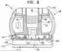 Fig. 15 - Annuloplasty implants