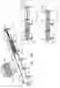 Fig. 18 - Annuloplasty implants