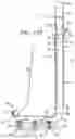 Fig. 25 - Annuloplasty implants