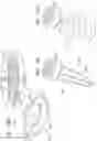 Fig. 31 - Annuloplasty implants