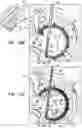 Fig. 37 - Annuloplasty implants