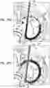 Fig. 40 - Annuloplasty implants
