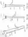 Fig. 03 - Total joint replacement infection control devices and methods