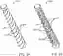 Fig. 04 - Total joint replacement infection control devices and methods