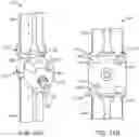 Fig. 18 - Total joint replacement infection control devices and methods