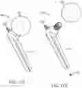 Fig. 22 - Total joint replacement infection control devices and methods