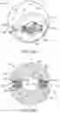 Fig. 28 - Total joint replacement infection control devices and methods