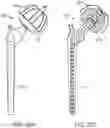 Fig. 30 - Total joint replacement infection control devices and methods