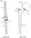 Fig. 36 - Total joint replacement infection control devices and methods