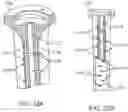 Fig. 37 - Total joint replacement infection control devices and methods