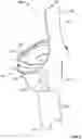 Fig. 06 - Fixation devices and prostheses for soft tissue connection to the same