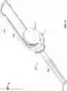 Fig. 12 - Fixation devices and prostheses for soft tissue connection to the same