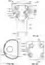Fig. 20 - Fixation devices and prostheses for soft tissue connection to the same