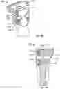 Fig. 26 - Fixation devices and prostheses for soft tissue connection to the same