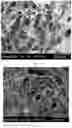 Fig. 04 - COLLAGEN-BASED MENISCUS IMPLANTS