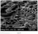 Fig. 05 - COLLAGEN-BASED MENISCUS IMPLANTS