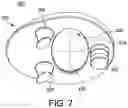 Fig. 06 - Patellar implant