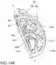 Fig. 28 - Coiled implants and systems and methods of use thereof