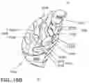 Fig. 33 - Coiled implants and systems and methods of use thereof