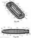 Fig. 22 - Intervertebral spinal implant