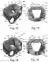 Fig. 25 - Intervertebral spinal implant