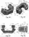 Fig. 26 - Intervertebral spinal implant
