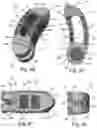 Fig. 29 - Intervertebral spinal implant