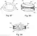 Fig. 31 - Intervertebral spinal implant