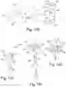 Fig. 37 - Intervertebral spinal implant