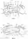 Fig. 05 - Expanding interbody implant and articulating inserter and methods of use