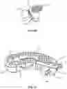 Fig. 11 - Expanding interbody implant and articulating inserter and methods of use