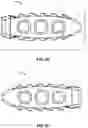 Fig. 10 - Spinal surgery systems and methods