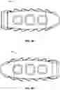 Fig. 14 - Spinal surgery systems and methods