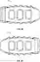 Fig. 22 - Spinal surgery systems and methods