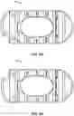 Fig. 25 - Spinal surgery systems and methods