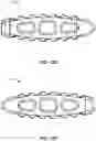 Fig. 38 - Spinal surgery systems and methods