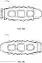 Fig. 46 - Spinal surgery systems and methods
